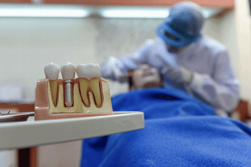 Dental implant model on tray with dentist treating patient in background