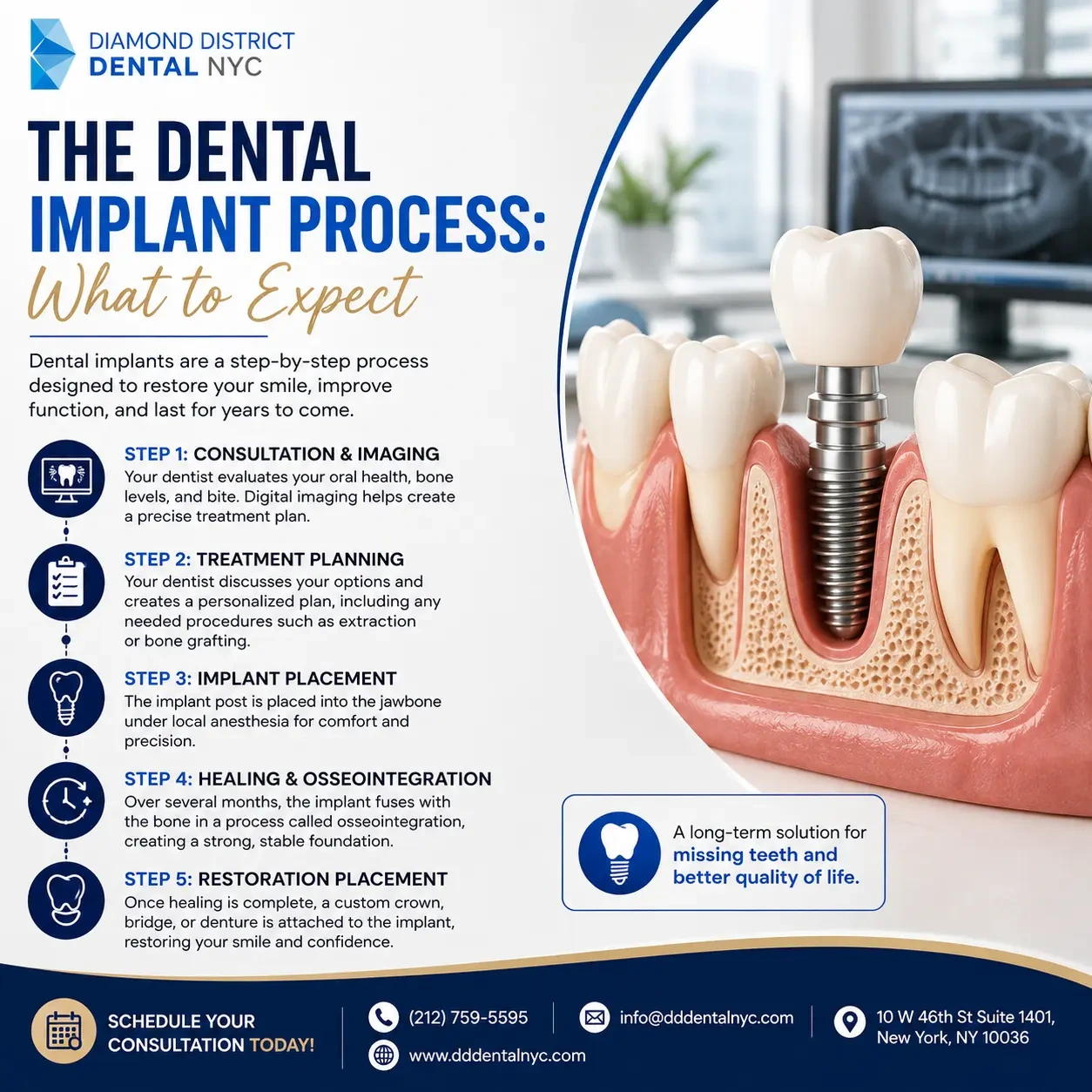 Dental implants in Midtown Manhattan infographic showing the five step dental implant process from consultation and imaging to implant placement, healing, and final restoration.
