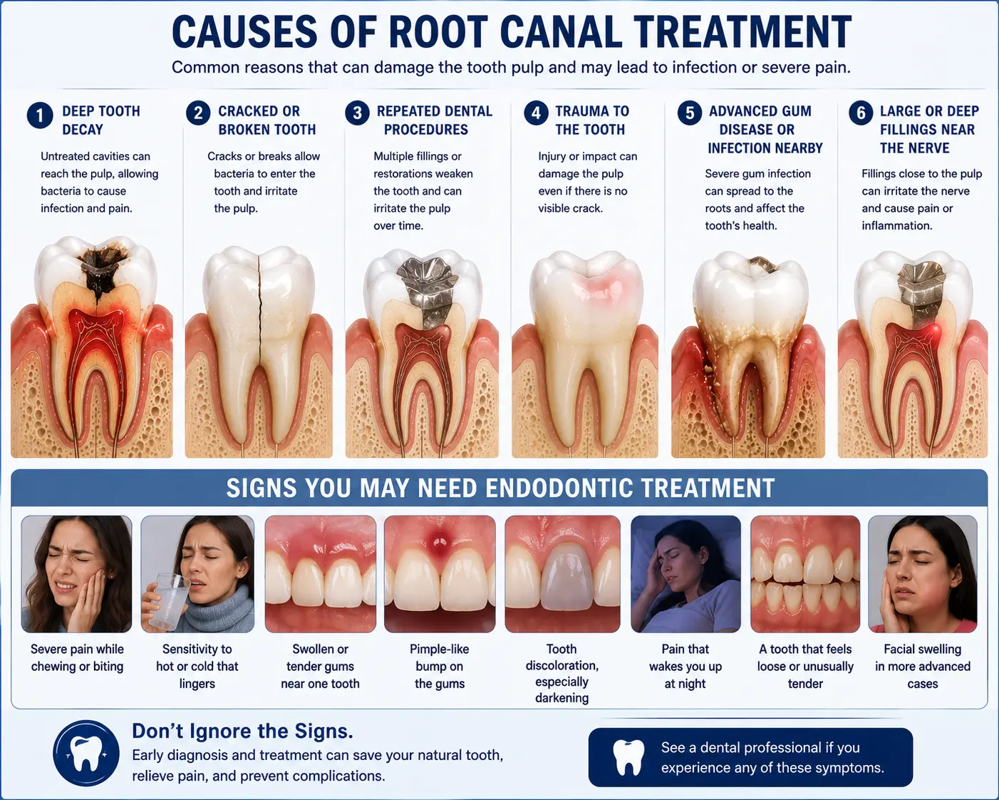 What are the causes of root canal infographic showing six common causes of root canal treatment and warning signs that may indicate the need for endodontic care.